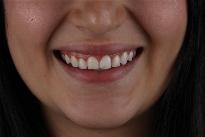 Close do sorriso