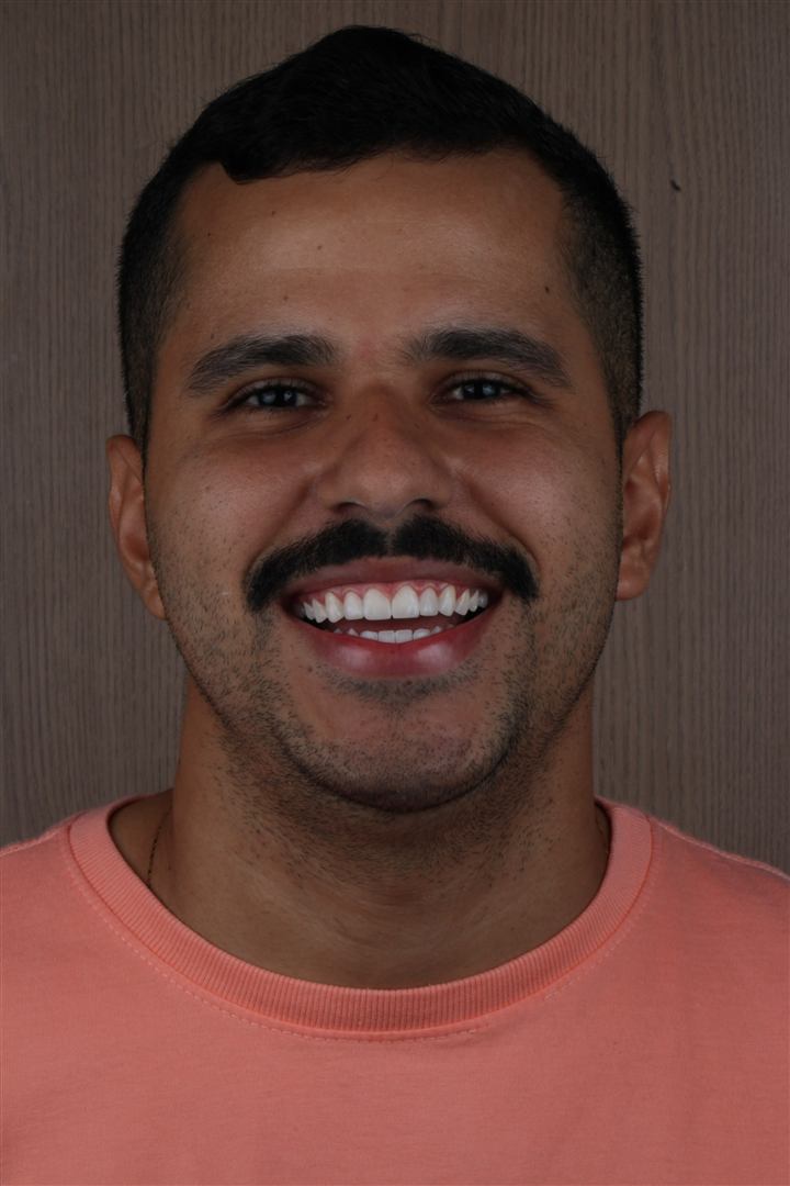 Sorriso renovado